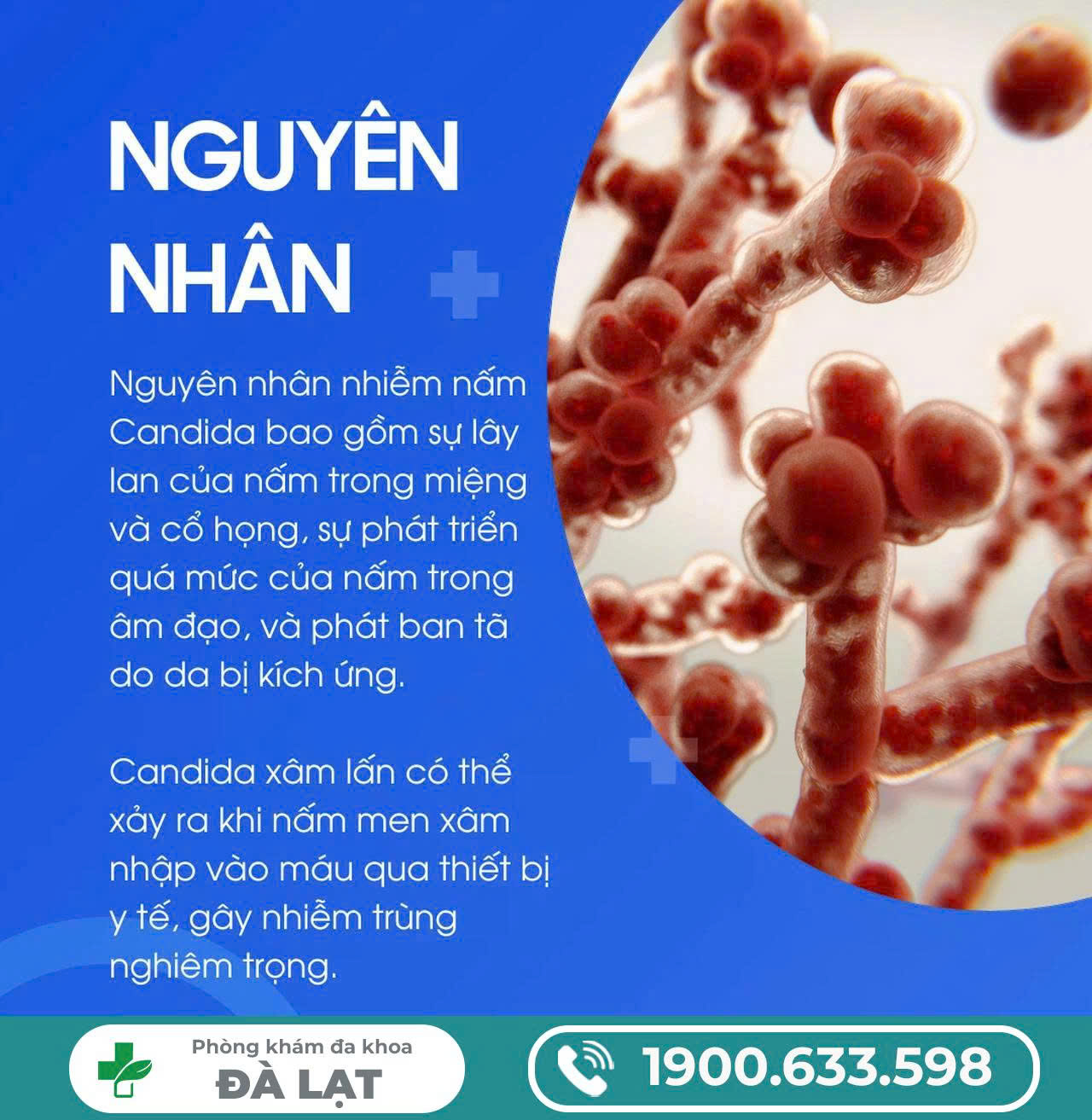 Hình ảnh minh họa